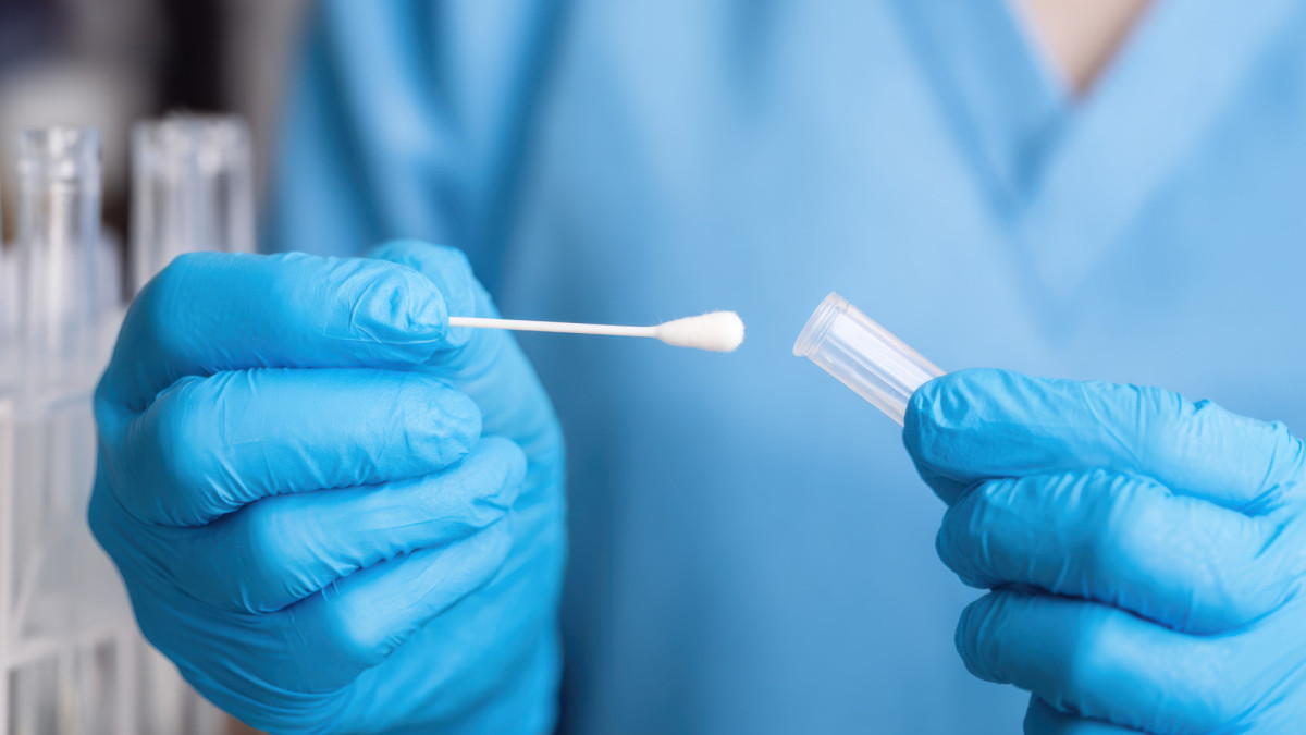 Verkoop van soa- en hpv-testkits vrijgesteld van btw?